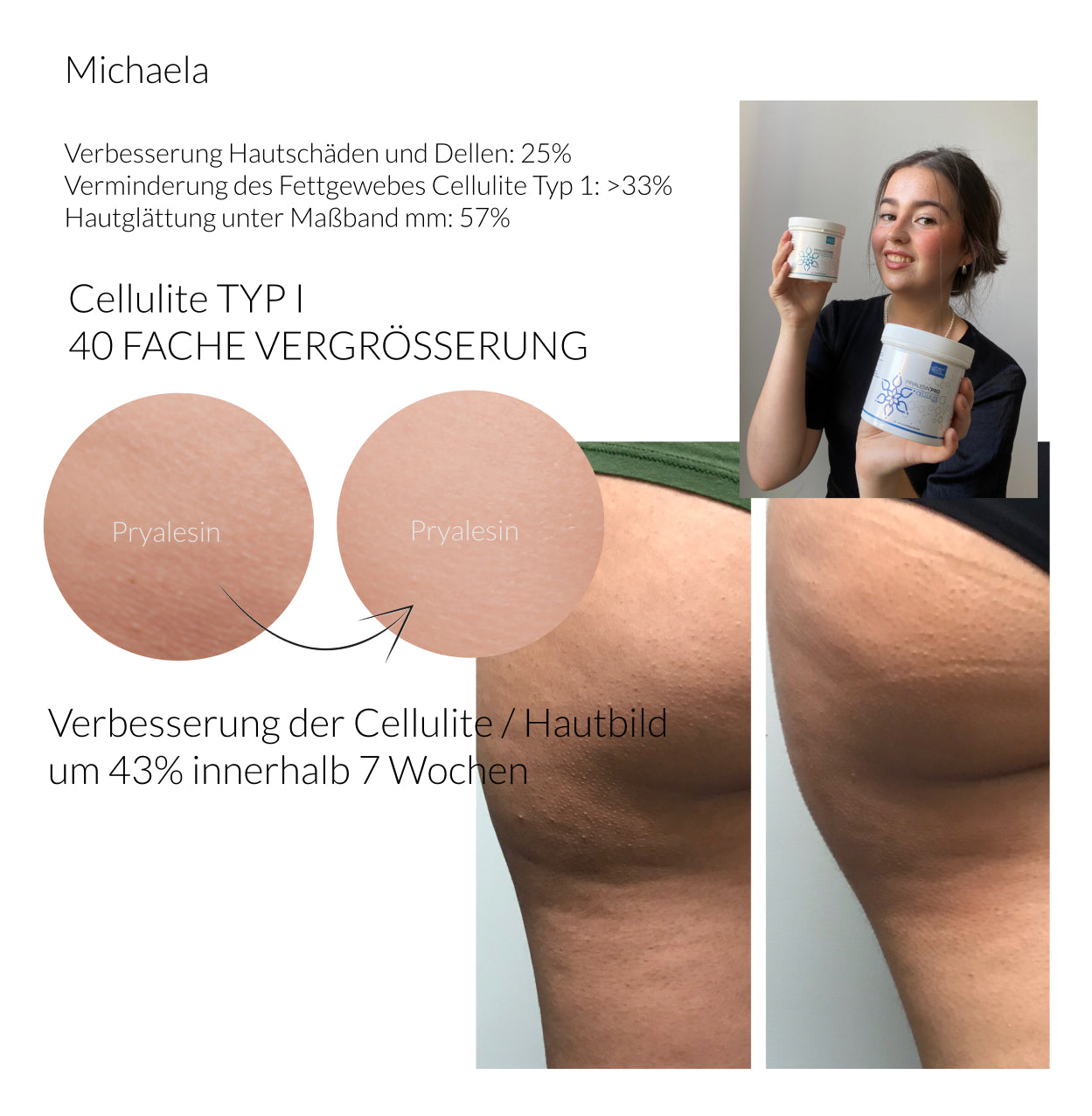 Pryalesin Tag und Nacht Creme Set 2x250ml (+50% gratis Tiegel)