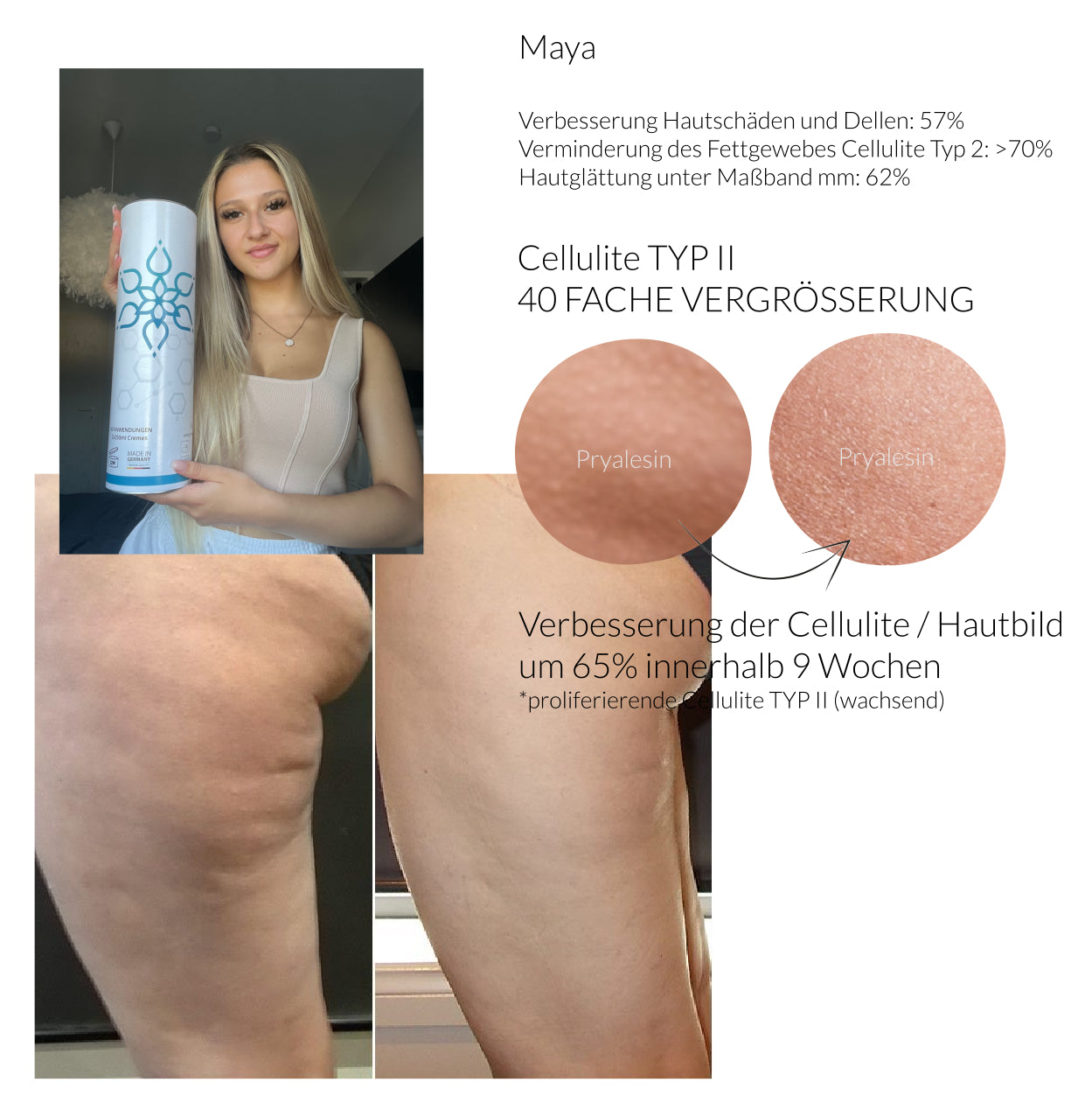 Premium Set: Pryalesin3 Tag und Nacht Creme Set 4x250ml (+50% gratis Tiegel)